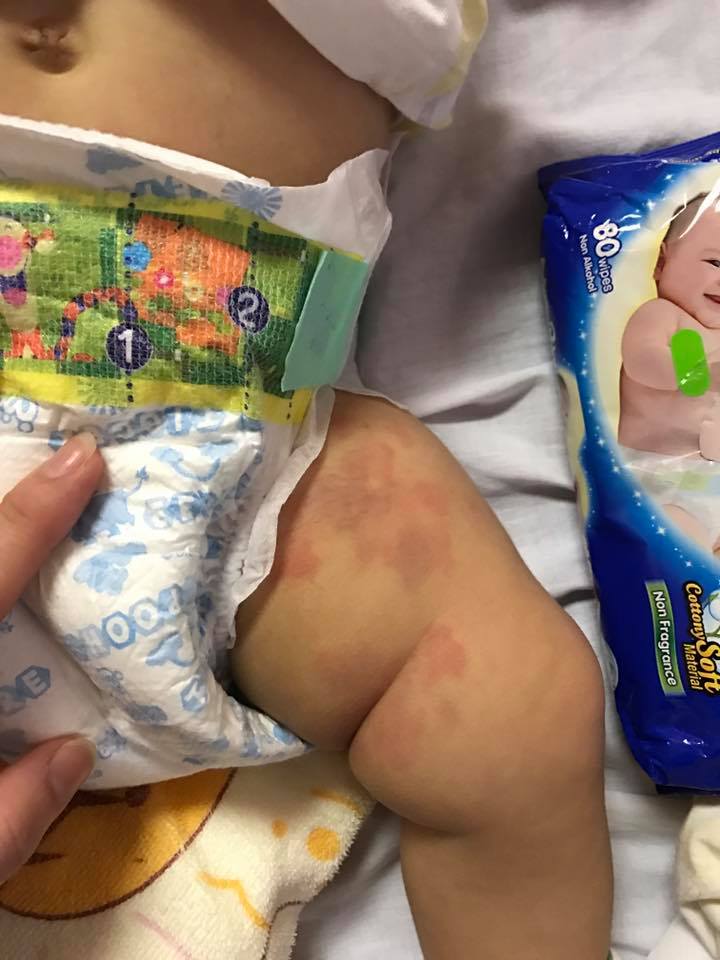 Kisah bayi salah diagnosis ini bikin para ibu harus waspada