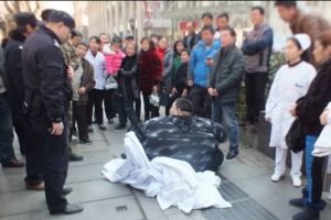 Dulu dijuluki pria tergemuk di China, begini kondisinya sekarang