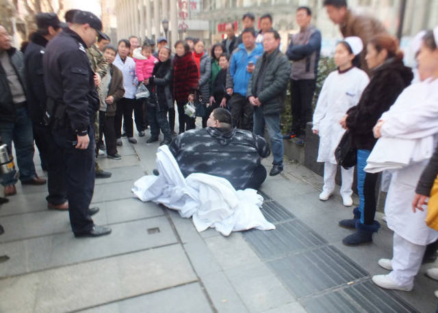 Dulu dijuluki pria tergemuk di China, begini kondisinya sekarang