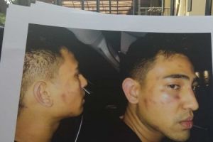 Axel Matthew babak belur, Jeremy Thomas lapor Propam