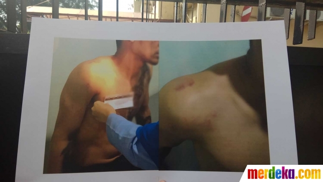 Axel Matthew babak belur, Jeremy Thomas lapor Propam