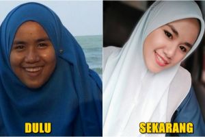 Dulu diejek badak, transformasi gadis ini bikin melongo