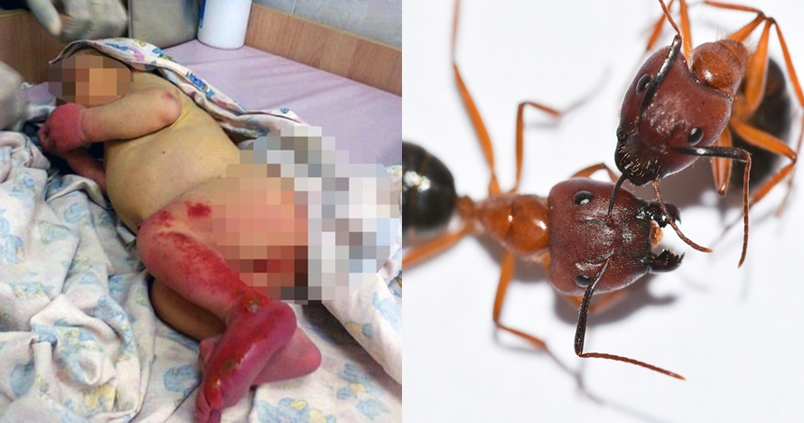 Tragis, bayi usia 3 hari ini dibuang ke hutan hingga dimakan semut