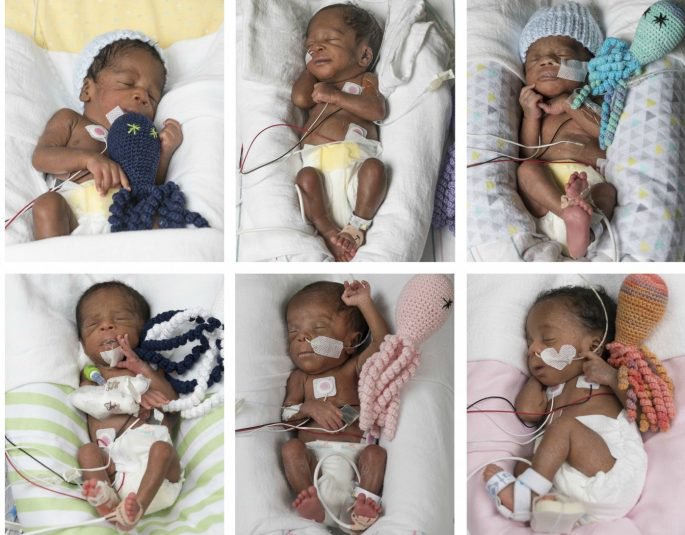 17 Tahun menunggu, pasangan ini dikaruniai anak kembar 6 sekaligus