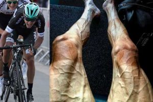 Potret ngeri kaki atlet balap sepeda dunia, ini lho penyebabnya