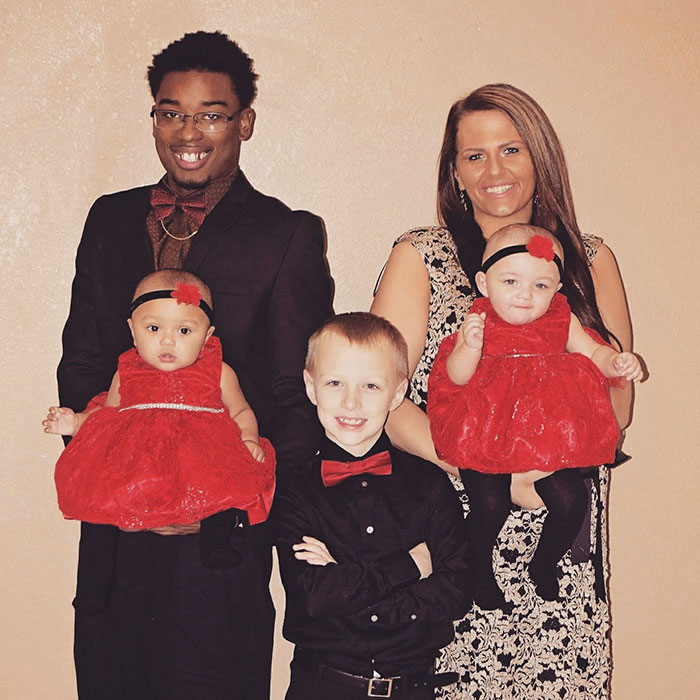 Kisah bayi kembar yang terlihat beda ras, langka tapi nyata