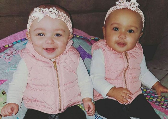Kisah bayi kembar yang terlihat beda ras, langka tapi nyata
