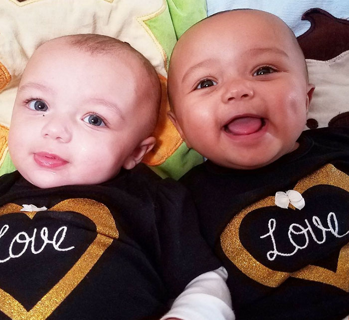 Kisah bayi kembar yang terlihat beda ras, langka tapi nyata