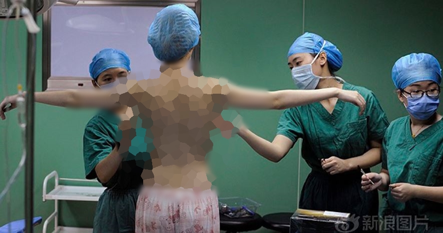 Salah dokter, hasil oplas payudara wanita ini malah jadi mengerikan