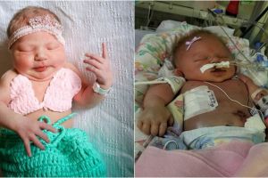 Kisah haru bayi meninggal setelah tertular penyakit melalui cium bibir