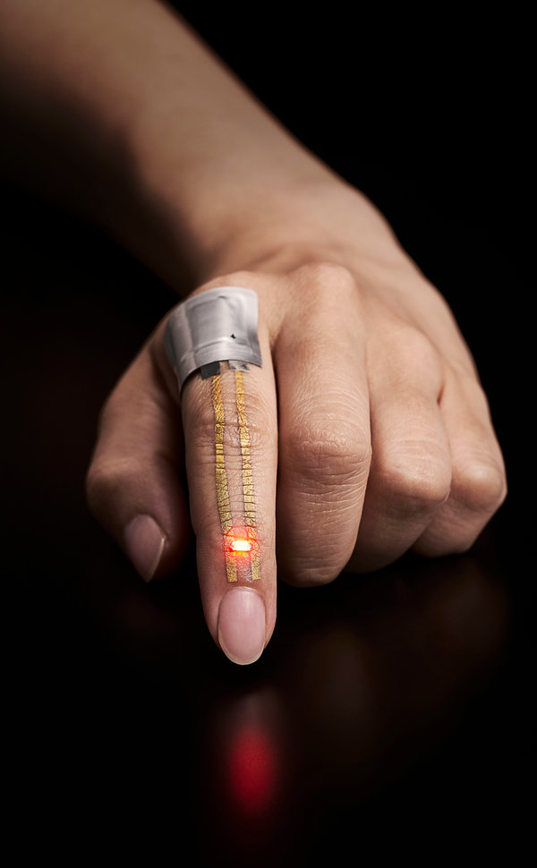 Sensor kesehatan kulit ini mirip tato temporer lho, keren