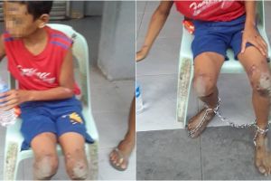 Heboh potret seorang bocah dirantai dengan luka di sekujur tubuh