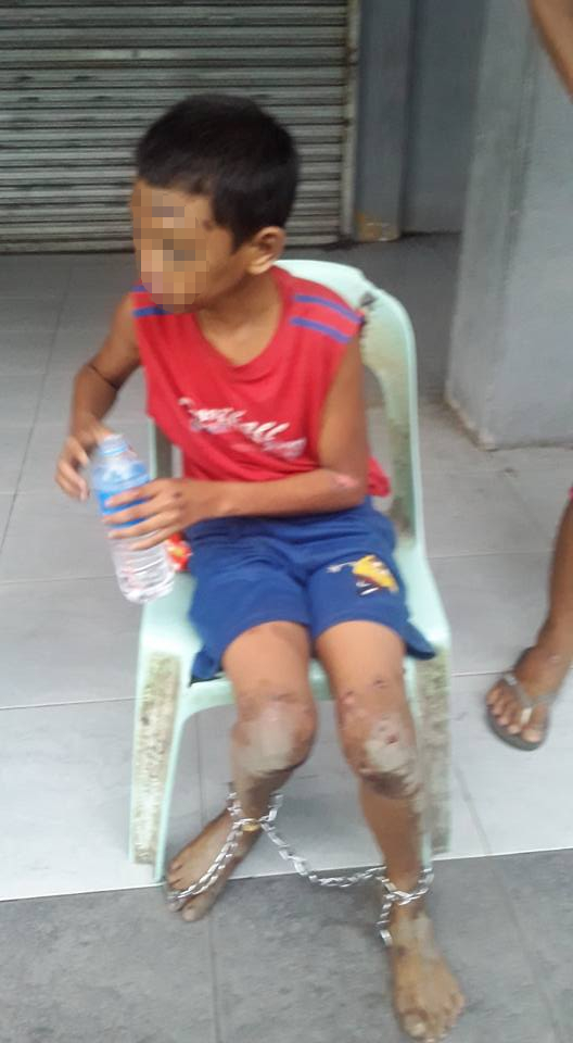 Heboh potret seorang bocah dirantai dengan luka di sekujur tubuh