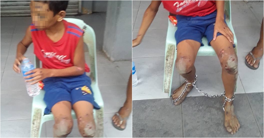 Heboh potret seorang bocah dirantai dengan luka di sekujur tubuh