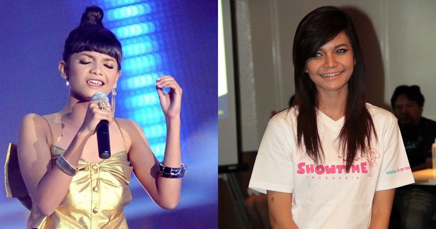 12 Foto transformasi Citra Scholastika, kini cantik bak Kylie Jenner