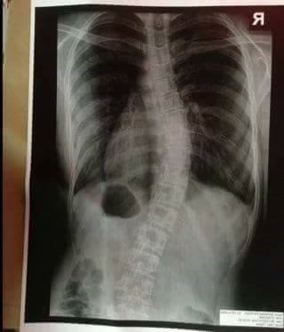 Terlihat normal dan cantik, kondisi wanita ini ternyata memprihatinkan