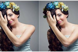 Lahir dengan cacat bawaan di wajah, gadis ini pede jadi 'model selfie'