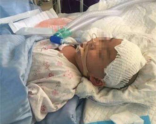 Keinginan gadis kecil yang idap tumor otak ini bikin terenyuh