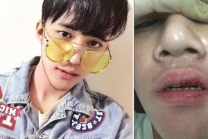 Kronologi pengeroyokan Dicky Smash hingga babak belur