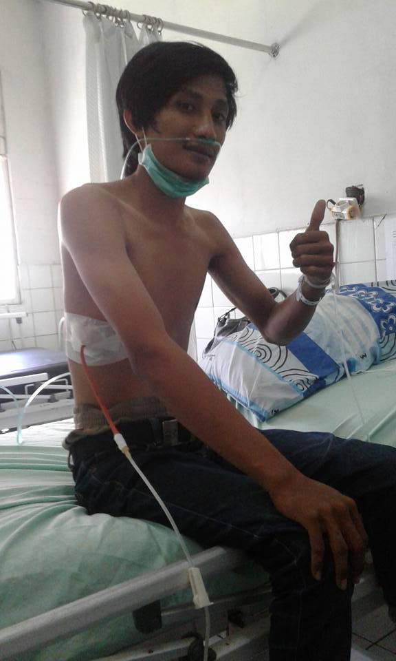 Paru-paru suami harus dibor karena rokok, wanita ini curahkan isi hati