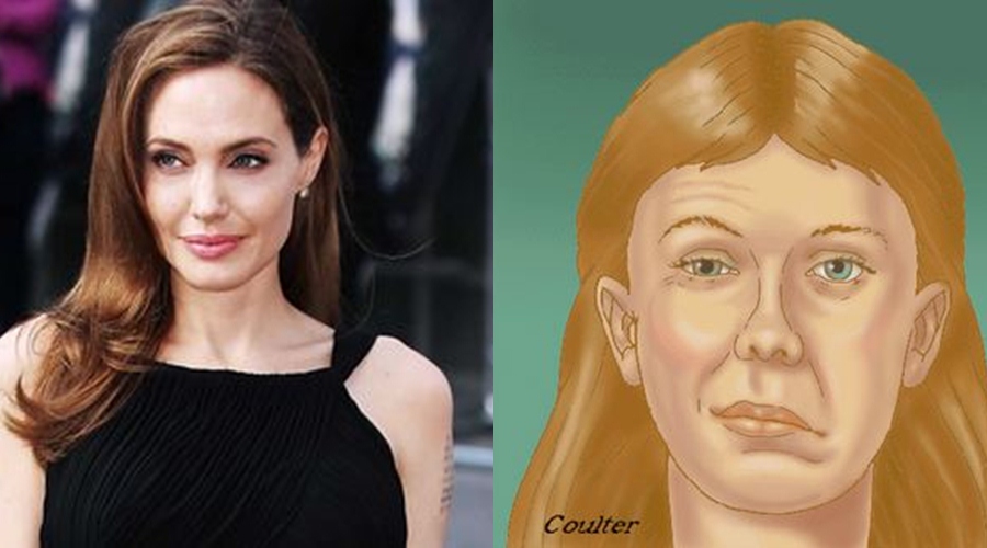 Wajah Angelina Jolie yang sebelah jadi kaku, ini ternyata penyebabnya