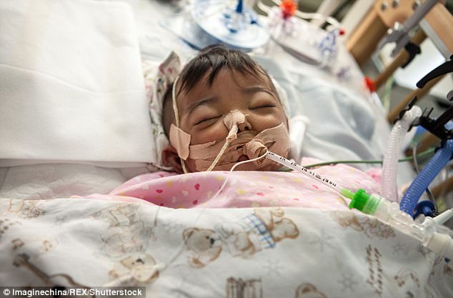 Derita penyakit langka, bayi ini ditinggal orangtuanya di rumah sakit