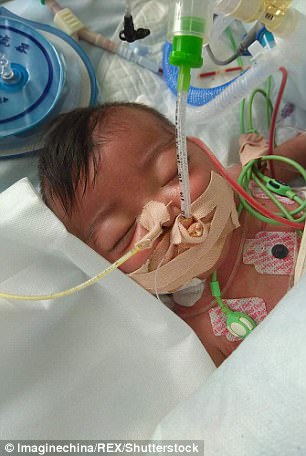 Derita penyakit langka, bayi ini ditinggal orangtuanya di rumah sakit