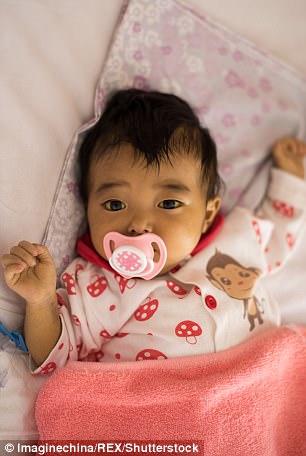 Derita penyakit langka, bayi ini ditinggal orangtuanya di rumah sakit