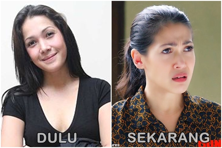 Transformasi penampilan para pemain Extravaganza, Tora gimana ya?