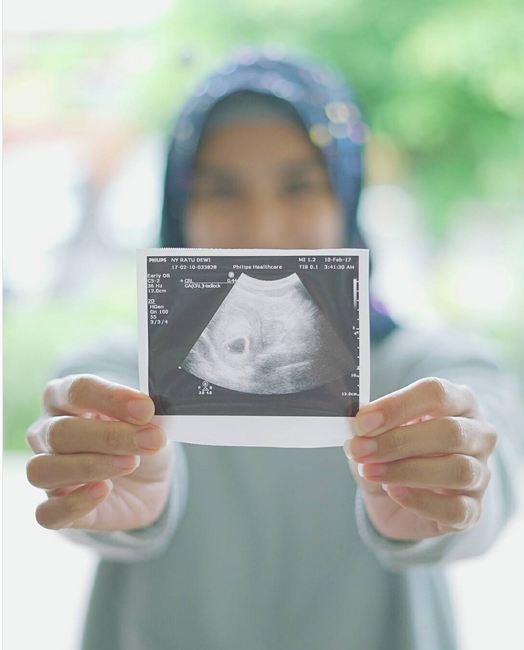 Menanti kelahiran bayi, ini 11 foto kemesraan Mario Irwinsyah & istri