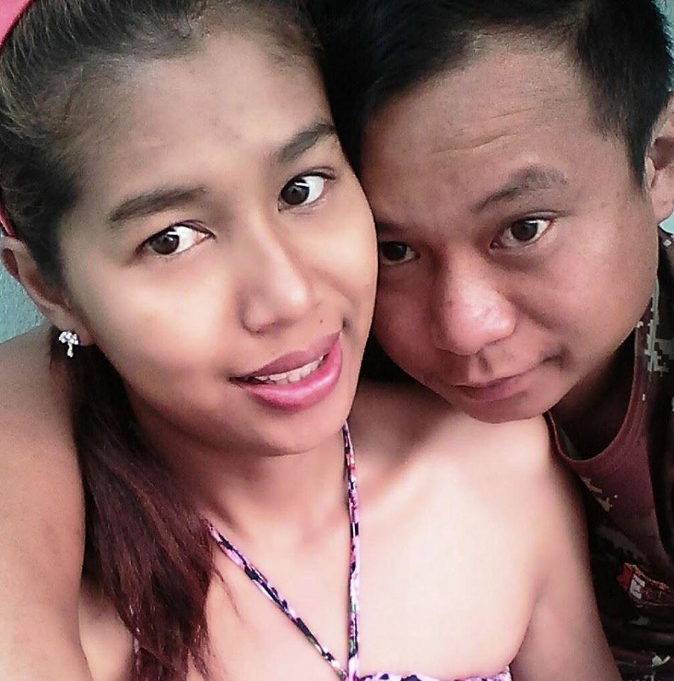 Gara-gara selfie, tubuh wanita ini dibakar suaminya yang cemburu buta