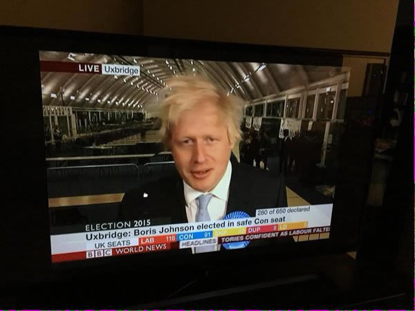 6 Orang ini alami penyakit aneh, rambutnya berdiri & tak bisa disisir