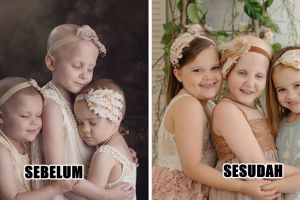 Potret 12 pengidap kanker sebelum vs sesudah sembuh, top perjuangannya