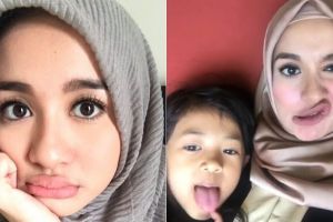 10 Potret Laudya Cynthia Bella tetap cantik meski berpose jelek