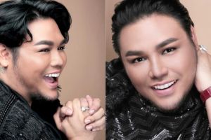 Terungkap, ini bagian tubuh Ivan Gunawan yang pernah dioperasi plastik