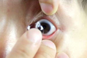 Lupa lepas softlens selama 5 bulan, mata wanita ini alami kebutaan