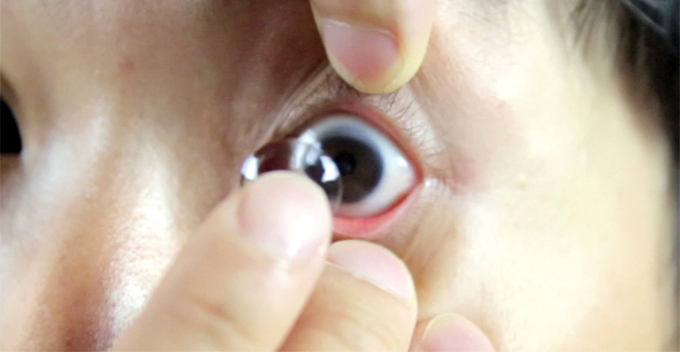 Lupa lepas softlens selama 5 bulan, mata wanita ini alami kebutaan