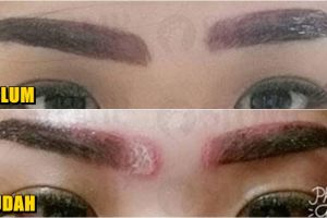 Ingin cantik dengan sulam alis, wanita ini malah luka mengerikan