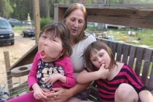 Dokter sampai bingung obati anak ini gara-gara idap penyakit langka