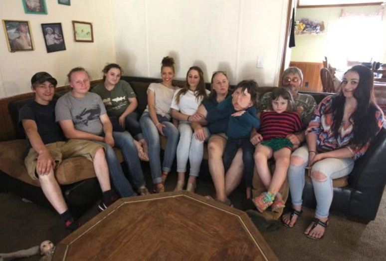 Dokter sampai bingung obati anak ini gara-gara idap penyakit langka