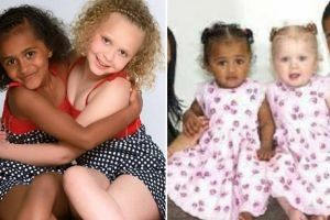 10 Pasangan beda warna kulit ini ternyata saudara kembar, tak nyangka