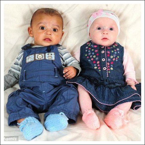 10 Pasangan beda warna kulit ini ternyata saudara kembar, tak nyangka