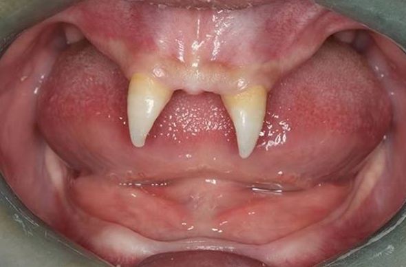 8 Kasus aneh seputar gigi, ada yang tumbuh di mata