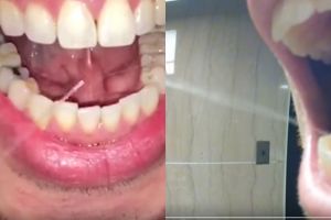 Tak semua orang bisa melakukan 10 aktivitas ini, bola mata keluar lho