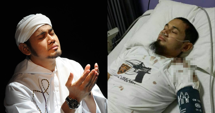 Masuk ICU, begini kronologi kecelakaan yang dialami Ustaz Guntur Bumi