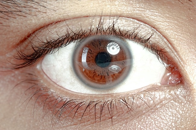 Jangan sepelekan, 12 kondisi mata ini bisa jadi indikator kesehatanmu