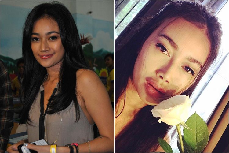 Perubahan drastis bentuk bibir 7 selebriti cantik 