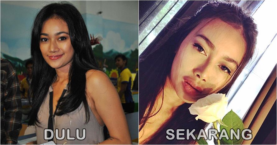 Perubahan drastis bentuk bibir 7 selebriti cantik 