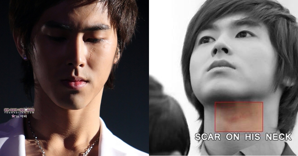 6 Idol K-Pop ini punya bekas luka wajah serius yang nggak bisa hilang