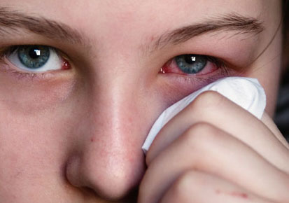 Kalau kamu ngalami 5 gejala ini, matamu lelah guys